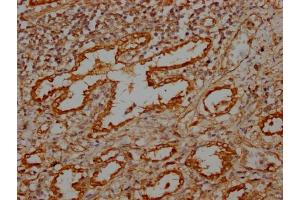 IHC image of ABIN7159372 diluted at 1:100 and staining in paraffin-embedded human lung tissue performed on a Leica BondTM system. (MBTPS1 抗体  (AA 187-400))