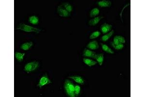 Immunofluorescent analysis of MCF-7 cells using ABIN7172301 at dilution of 1:100 and Alexa Fluor 488-congugated AffiniPure Goat Anti-Rabbit IgG(H+L) (NFKBIL2 抗体  (AA 668-955))