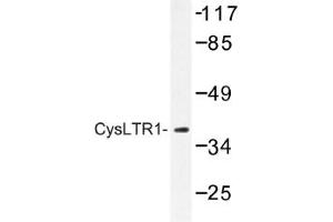 Image no. 1 for anti-Cysteinyl Leukotriene Receptor 1 (CYSLTR1) antibody (ABIN317631) (CysLTR1 抗体)