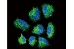 Confocal immunofluorescent analysis of CHAT Antibody (N-term) (ABIN653544 and ABIN2842929) with NCI- cell followed by Alexa Fluor? (Choline Acetyltransferase 抗体  (N-Term))