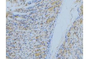 ABIN6277300 at 1/100 staining Human gastric tissue by IHC-P. (NDUFS1 抗体  (N-Term))