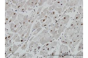 Immunoperoxidase of monoclonal antibody to MECP2 on formalin-fixed paraffin-embedded human heart. (MECP2 抗体  (AA 81-170))