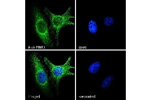 Flow Cytometry (FACS) image for anti-PTEN Induced Putative Kinase 1 (PINK1) (Internal Region) antibody (ABIN334460)