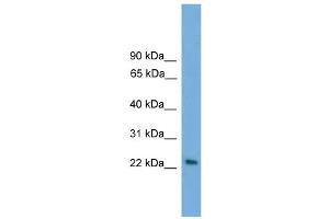 WB Suggested Anti-RAB15 Antibody Titration: 0. (RAB15 抗体  (Middle Region))