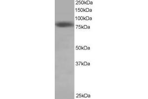 Western Blotting (WB) image for anti-NDC80 Kinetochore Complex Component Homolog (NDC80) (C-Term) antibody (ABIN2465807) (NDC80 抗体  (C-Term))