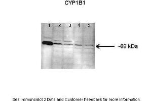 Western Blotting (WB) image for anti-Cytochrome P450, Family 1, Subfamily B, Polypeptide 1 (CYP1B1) (Middle Region) antibody (ABIN2784612)