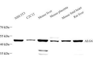 Western blot analysis of ALG6 (ABIN7073127) at dilution of 1: 1000 (ALG6 抗体)
