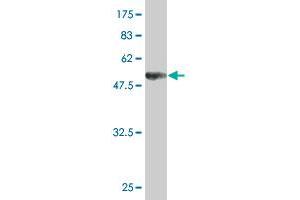 Western Blot detection against Immunogen (52. (UNC119 抗体  (AA 1-240))