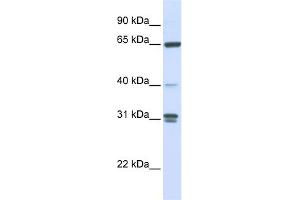 WB Suggested Anti-GBP2 Antibody Titration: 0. (GBP2 抗体  (N-Term))