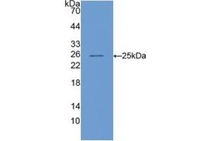 Western blot analysis of recombinant Mouse COMP. (COMP 抗体  (AA 554-753))