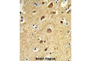 Immunohistochemistry (IHC) image for anti-Mitogen-Activated Protein Kinase 8 Interacting Protein 1 (MAPK8IP1) antibody (ABIN3004004) (MAPK8IP1 抗体)