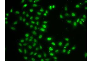 Immunofluorescence analysis of MCF-7 cells using DUSP22 antibody (ABIN4903528). (DUSP22 抗体)