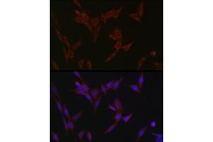 Immunofluorescence analysis of NIH/3T3 cells using ZIP14 Rabbit pAb (ABIN6133191, ABIN6147993, ABIN6147994 and ABIN6214658) at dilution of 1:100 (40x lens). (SLC39A14 抗体  (AA 240-340))