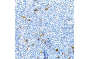 Immunohistochemistry of paraffin-embedded human tonsil using PVALB Antibody (ABIN5971476) at dilution of 1/100 (40x lens). (PVALB 抗体)
