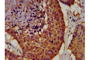 Immunohistochemistry (IHC) image for anti-POU Class 5 Homeobox 1 (POU5F1) (AA 1-360) antibody (ABIN7164068)