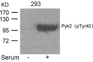 Western blot analysis of extracts from 293 cells untreated or treated with Serum using Pyk2(Phospho-Tyr402) Antibody. (PTK2B 抗体  (pTyr402))