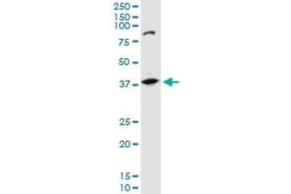 AKR1B10 antibody  (AA 76-143)