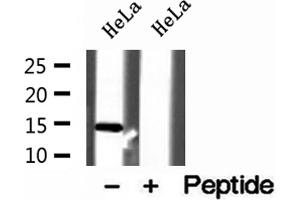 Western blot analysis of extracts of HeLa cells, using UQCRB antibody. (UQCRB 抗体  (N-Term))