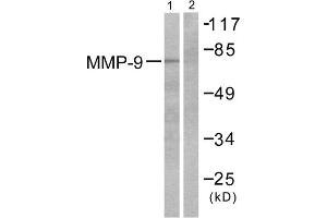 Western blot analysis of extracts from HepG2 cells, using MMP9 antibody (ABIN5976466). (MMP 9 抗体  (C-Term))