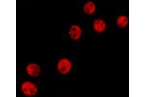 ABIN6277236 staining  Hela cells by IF/ICC. (TCOF1 抗体  (N-Term))
