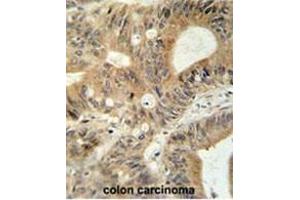 Immunohistochemistry (Paraffin-embedded Sections) (IHC (p)) image for anti-ATP-Binding Cassette, Sub-Family C (CFTR/MRP), Member 3 (ABCC3) (AA 906-933), (Middle Region) antibody (ABIN950200)