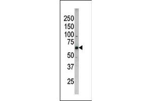 The anti-Phospho-CDC25B- Pab (ABIN389534 and ABIN2839581) is used in Western blot to detect Phospho-CDC25B- in SK-BR-3 tissue lysate (CDC25B 抗体  (pSer187))