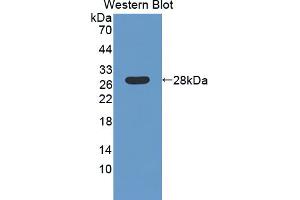 Western blot analysis of the recombinant protein. (LAMb4 抗体  (AA 1543-1759))