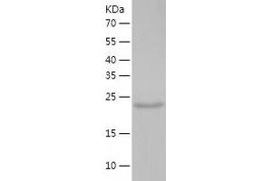 Western Blotting (WB) image for Methyltransferase Like 21D (METTL21D) (AA 1-229) protein (His tag) (ABIN7123946)