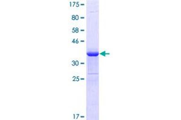 GATA3 Protein (AA 103-200) (GST tag)