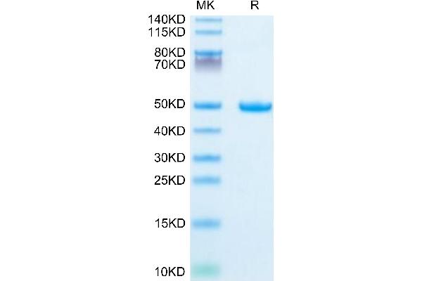 LGALS1/Galectin 1 Protein (AA 2-135) (Fc Tag)