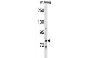 Western Blotting (WB) image for anti-Dachshund 1 (DACH1) antibody (ABIN2999622) (DACH1 抗体)