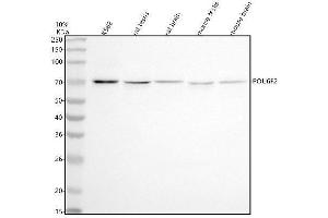 Western blot analysis of POU6F2 using anti-POU6F2 antibody (ABIN7600834).