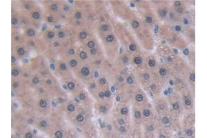 Detection of IL6 in Rat Liver Tissue using Monoclonal Antibody to Interleukin 6 (IL6) (IL-6 抗体  (AA 21-211))