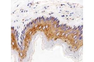 Immunohistochemical analysis of paraffin-embedded rat esophagus using EGF Receptor antibody at 1:25 dilution. (EGFR 抗体  (AA 1163-1191))