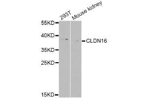 Western blot analysis of extracts of various cell lines, using CLDN16 Antibody (ABIN6003594) at 1/1000 dilution. (Claudin 16 抗体)