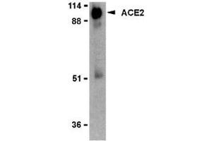Western blot analysis of ACE2 in human kidney lysate with AP30009PU-N ACE2 antibody (IN2) at 2 μg/ml. (ACE2 抗体  (Intermediate Domain 2))