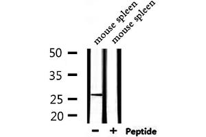 Western blot analysis of extracts from mouse spleen, using ARHGDIA Antibody. (ARHGDIA 抗体  (N-Term))