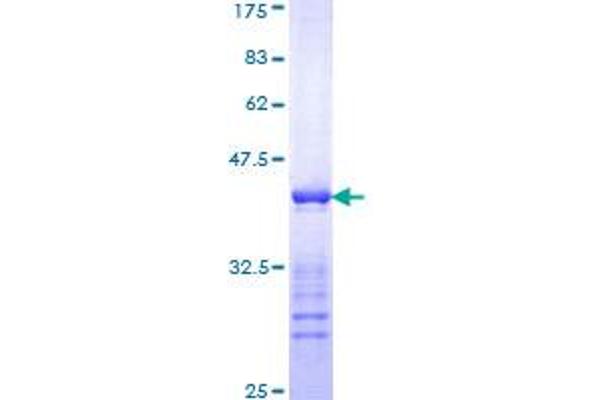 Keratin 10 Protein (KRT10) (AA 345-454) (GST tag)