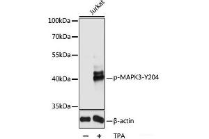 Western blot analysis of extracts of Jurkat cells using Phospho-MAPK3(Y204) Polyclonal Antibody at dilution of 1:2000.