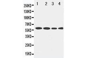 Anti-LCAT antibody, Western blotting Lane 1: Rat Brain Tissue Lysate Lane 2: U87 Cell Lysate Lane 3: HELA Cell Lysate Lane 4: SMMC Cell Lysate (LCAT 抗体  (C-Term))