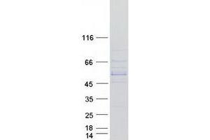 Validation with Western Blot
