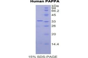 SDS-PAGE analysis of Human PAPPA Protein. (PAPPA 蛋白)