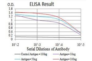 Black line: Control Antigen (100 ng), Purple line: Antigen(10 ng), Blue line: Antigen (50 ng), Red line: Antigen (100 ng), (CBX2 抗体  (AA 402-525))