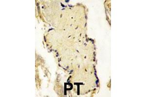 Formalin-fixed and paraffin-embedded placenta tissue reacted with SPPL2A polyclonal antibody  , which was peroxidase-conjugated to the secondary antibody, followed by DAB staining. (SPPL2A 抗体  (N-Term))