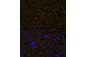 Immunofluorescence analysis of mouse brown adipose using Perilipin A Rabbit mAb (ABIN7269218) at dilution of 1:100 (40x lens). (PLIN1 抗体)