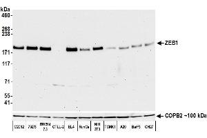 Western Blotting (WB) image for anti-Zinc Finger E-Box Binding Homeobox 1 (ZEB1) (C-Term) antibody (ABIN7795625)