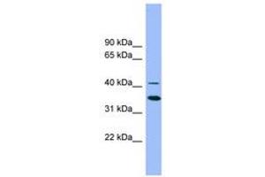 Image no. 1 for anti-GATA Binding Protein 5 (GATA5) (AA 323-372) antibody (ABIN6742225) (GATA5 抗体  (AA 323-372))