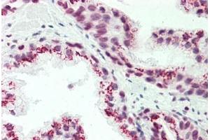 Human Prostate: Formalin-Fixed, Paraffin-Embedded (FFPE) (CASC4 抗体  (AA 336-365))