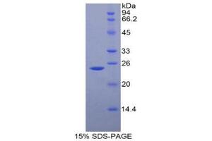 SDS-PAGE (SDS) image for Fibulin 2 (FBLN2) (AA 1013-1221) protein (His tag) (ABIN1878902)