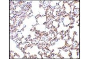 Immunohistochemistry of SnoN in mouse lung tissue with this product at 5 μg/ml. (SKIL 抗体  (N-Term))